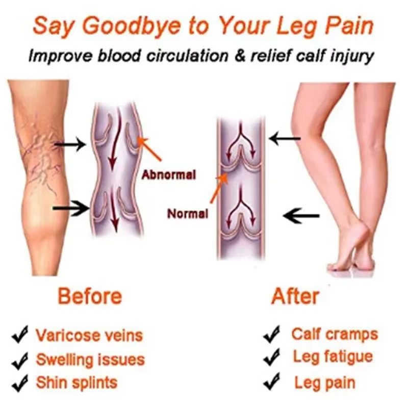 Women Compression Socks Slimmi - Compression Sock Medical review and price